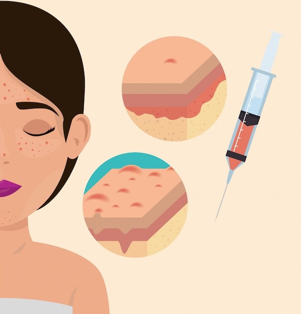 美容医美概念插画插图